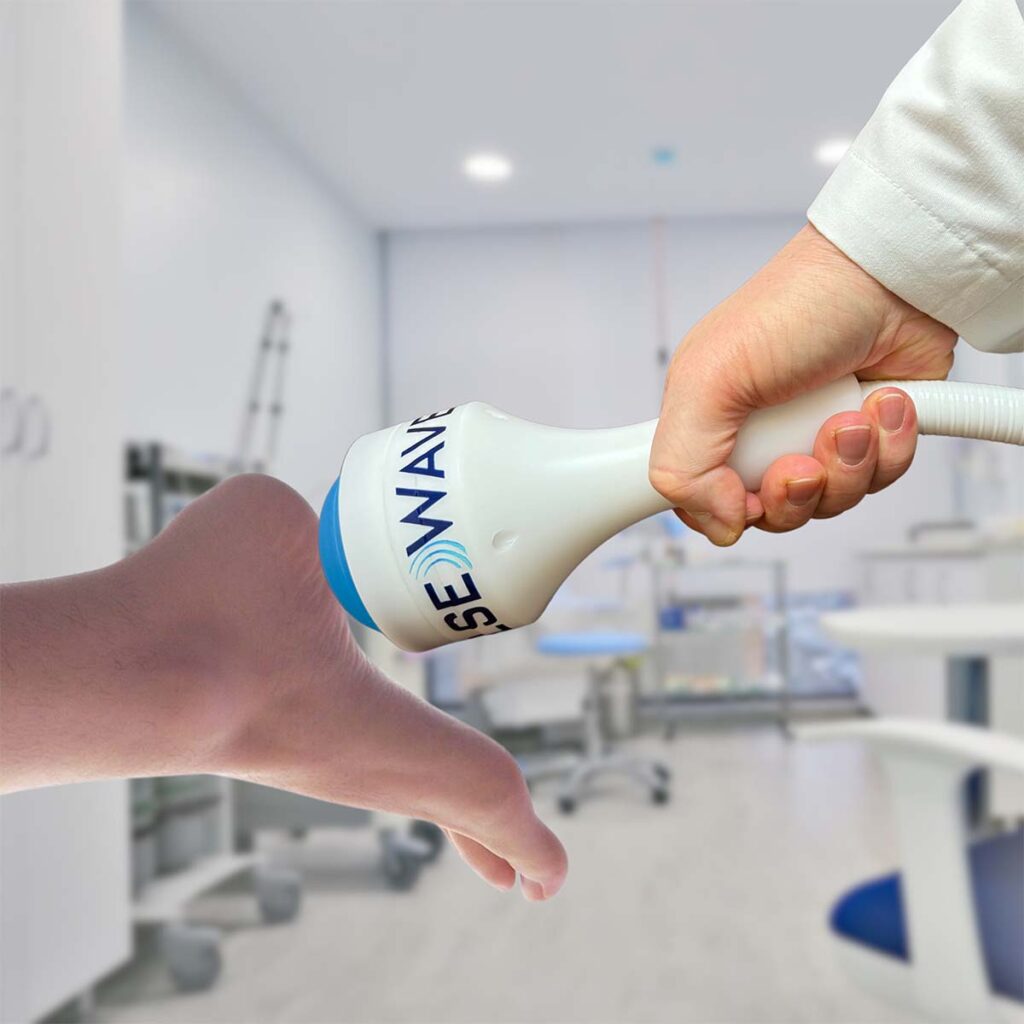Foot of patient receiving Shockwave Therapy at Atlas Peak in Pleasantville NY
