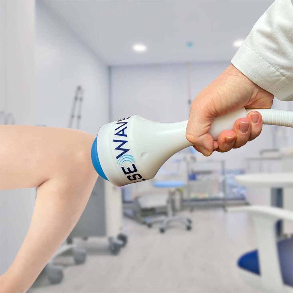 Elbow of patient receiving Shockwave Therapy at Atlas Peak in Pleasantville NY