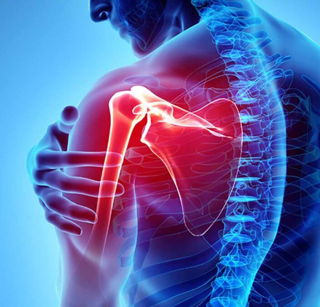 Illustration of joint pain at Atlas Peak physical therapy in Pleasantville NY